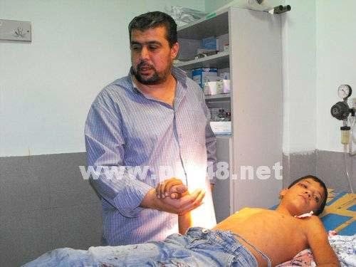 Kazada Filistinli çocuklar hafif şekilde yaralandı....