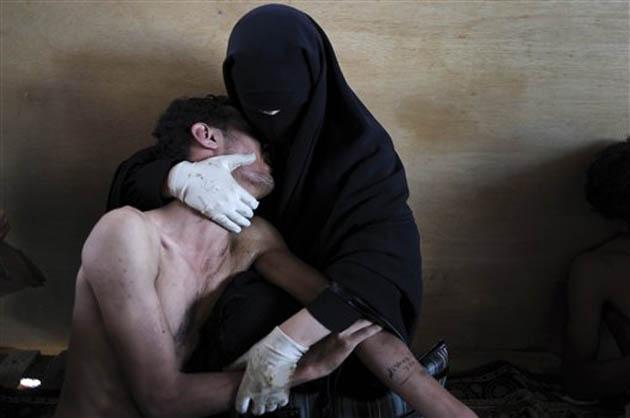 AP, İspanya'dan Samuel Aranda'nın, Yemen'in başkenti Sana'da Devlet Başkanı Ali Abdullah Salih'e karşı gösterilerde yaralanan yakınını tutan kadının fotoğrafını birinci seçti.