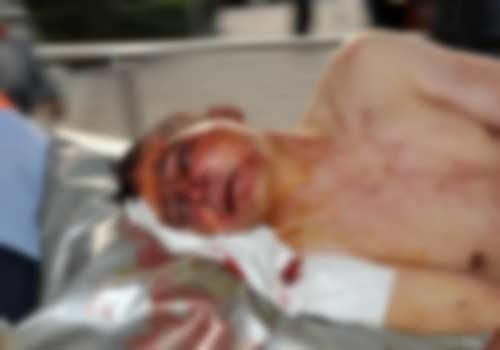 Maltepe Büyükbakkalköy'de, 2 kişi tarafından ormanlık alana götürülen Yiğit G. isimli şahıs, cinsel organı kesildikten sonra karnından bıçaklandı.