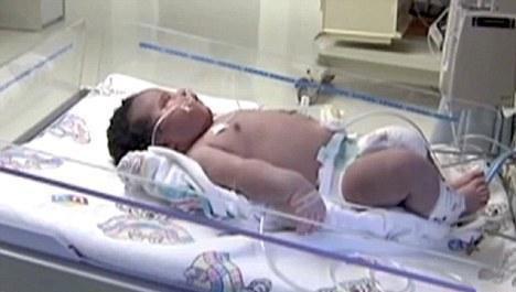 5 kilo civarında doğmasını bekledikleri bebekleri i&ccedil;in hastaneye yatan Brown &ccedil;ifti 7 kilo 300 gram ağırlığındaki bebekleriyle karşılaşınca, hastane g&ouml;revlileriyle birlikte b&uuml;y&uuml;k şaşkınlık yaşadı.