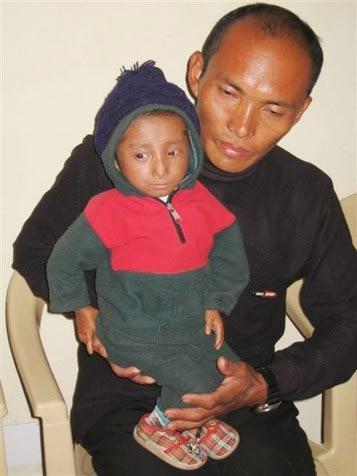 Adını Guinness Rekorlar Kitabı'na yazdıran Khagendra Thapa Magar adlı 17 yaşındaki Katmandulu genç adam kimsenin sahip olmadığı iki unvana birden sahip