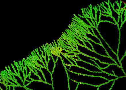 19. Eric Kalkman - Laboratory of Phytopathology - Wageningen University - Wageningen, Hollanda Konu mankeni:Latrunculin Bye maruz bırakılmış Neurospora crassanın (ekmek küfü) dallanması Büyütme: 200x