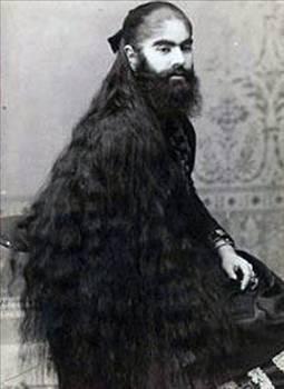 ANNIE JONES Annie Jones en güzel ve trajik sakallı bayanlardan biri. 19 yaşındayken çekilen üstteki fotoğrafta görülen Annie Jones, doğduğunda bile başından ayak parmağına kadar ince, koyu renkli tüy tabakası ile kaplıymış.
