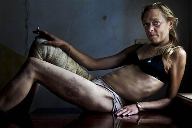Brent Stirton - Ukraynalı uyuşturucu bağımlısı bir seks işçisi