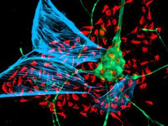 - İnsanların kendi hücrelerinden yedek organlar üretilecek.