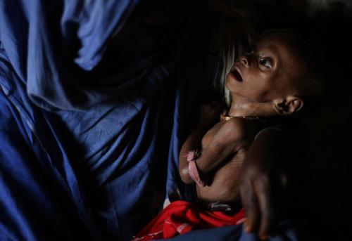 Bu bebek, yıllardır açlıkla mücadele eden ve Birleşmiş Milletler yardımlarının da soruna çare olamadığı Somalide, yaşıyor. Fotoğrafçının deklanşöre bastığı 11 Temmuz 2009 tarihinin makus kaderi olan açlığı değiştirmesini uman bebek, annesine biçare gözlerle bakıyor. (MOHAMED DAHIR/AFP/Getty Images)
