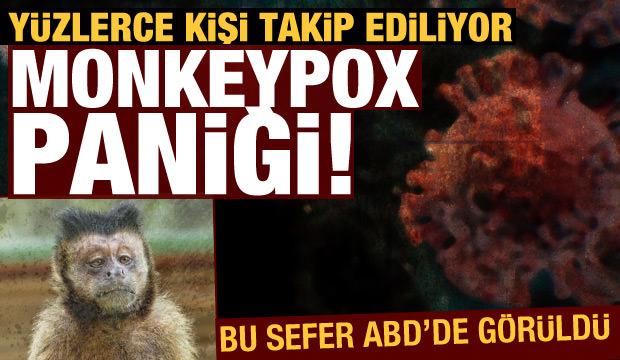 Monkeypox paniği! Yüzlerce kişi takip ediliyor (22 Temmuz 2021 Günün Önemli Gelişmeleri)