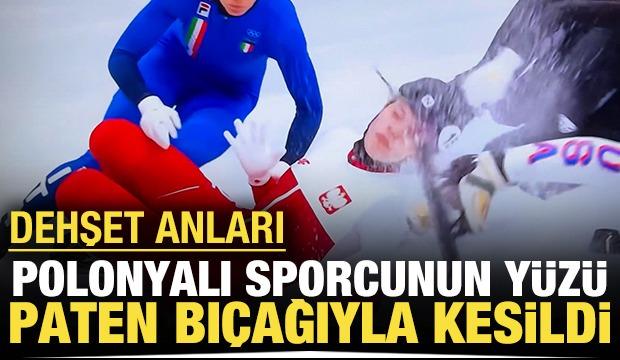 Dehşet anları: Polonyalı sporcunun y&uuml;z&uuml; paten bı&ccedil;ağıyla kesildi