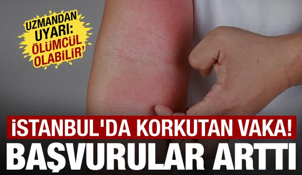 İstanbul'da b&uuml;y&uuml;k tehlike! Kuduz vakaları artıyor! En &ccedil;ok g&ouml;r&uuml;len il&ccedil;eler belli oldu