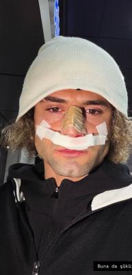 2. Lig'in gol kralının burnu kırıldı! Ma&ccedil;ı bu şekilde tamamladı